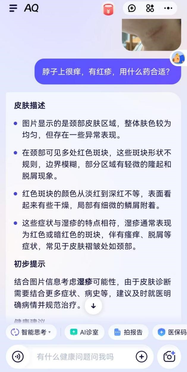 AI有用丨会追问能识图这个AI私人医生助理如何？(图4)