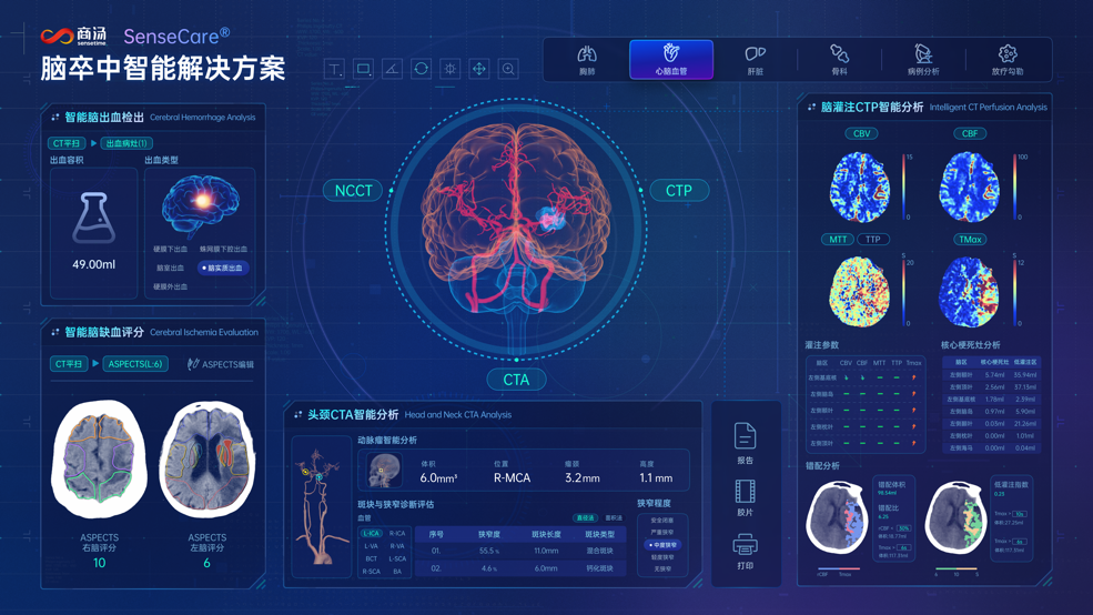 中国AI最新趋势来了！(图1)